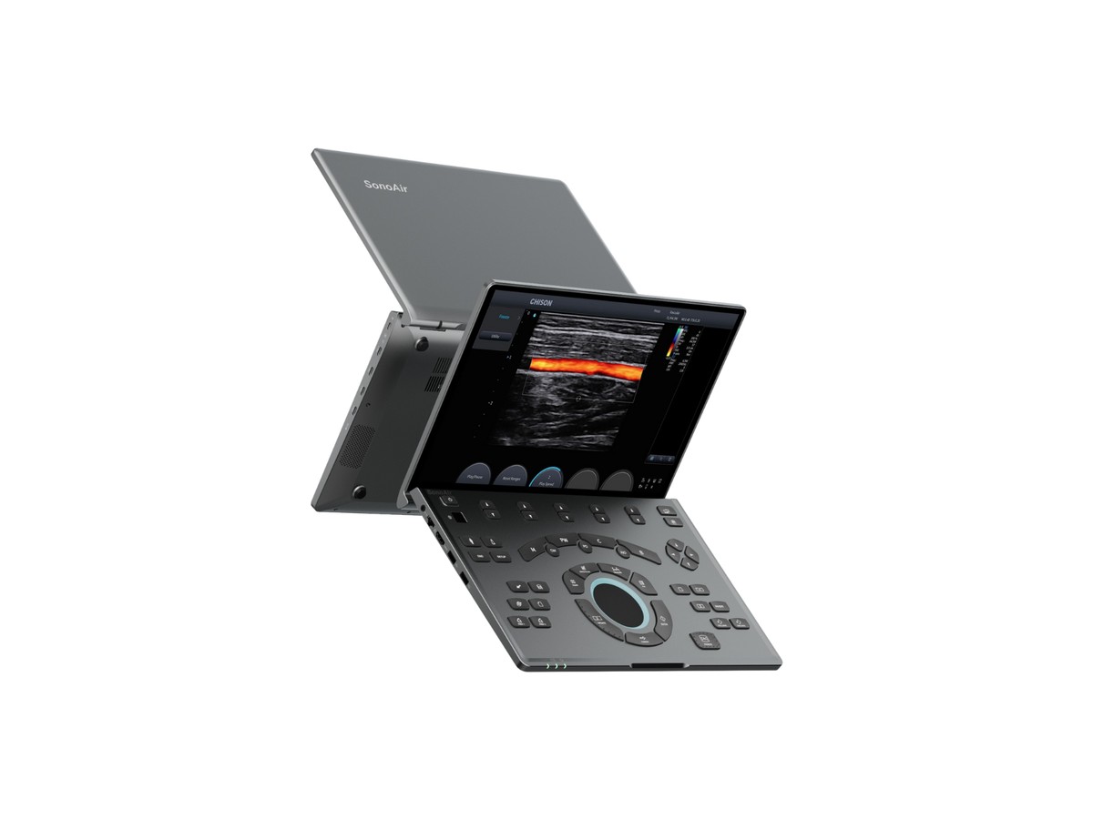 SonoAir — портативный УЗИ-аппарат CHISON